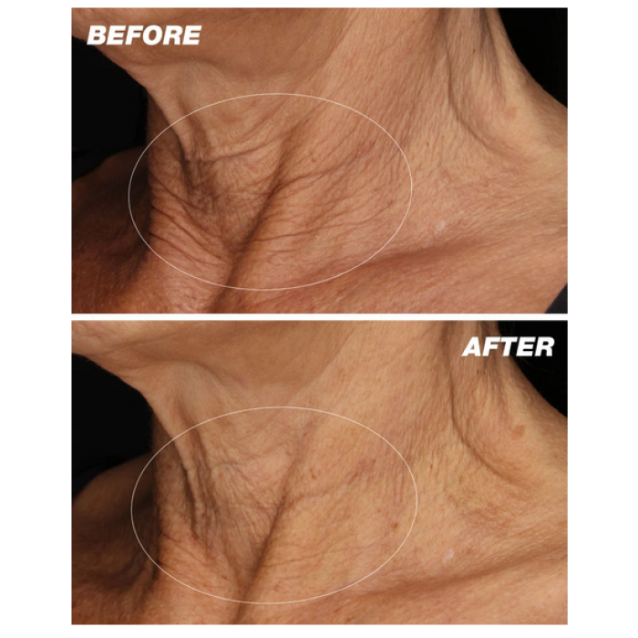 Dermalogica Neck Fit Contour Serum