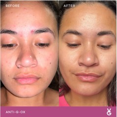 ANTI-G-OX Sachets - Berry 30 x 2g