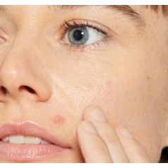 Deep Breakout Liquid Patch 15ml