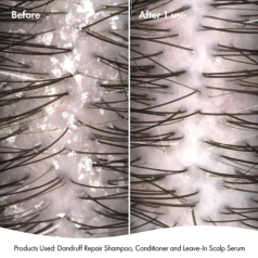 Dandruff Repair Leave-In Scalp Serum 125ml