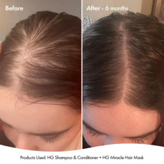 HG Miracle Hair Mask For Thinning Hair 250ml