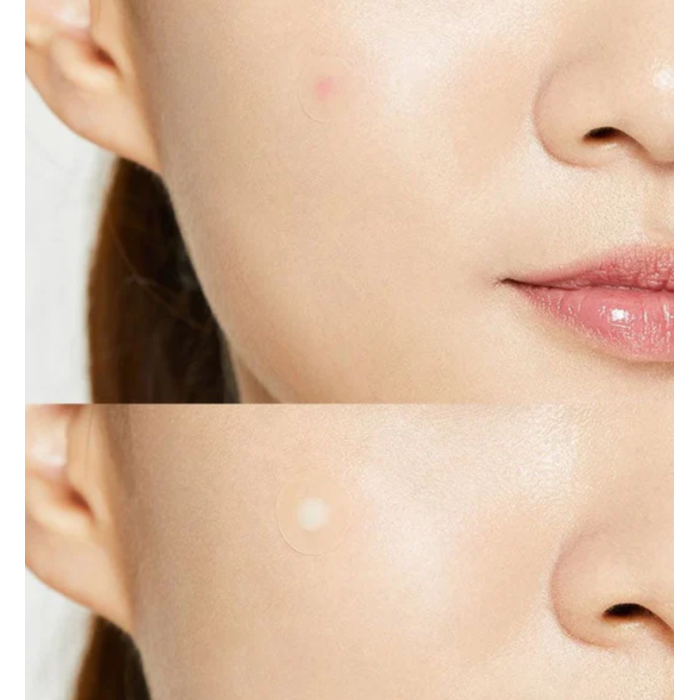 COSRX Acne Pimple Master Patch