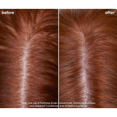 Biolage Scalp Sync Clarifying Shampoo 400ml