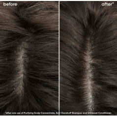 Biolage Scalp Sync Universal Conditioner 280ml