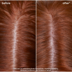 Biolage Scalp Sync Oil Balancing Serum 50ml