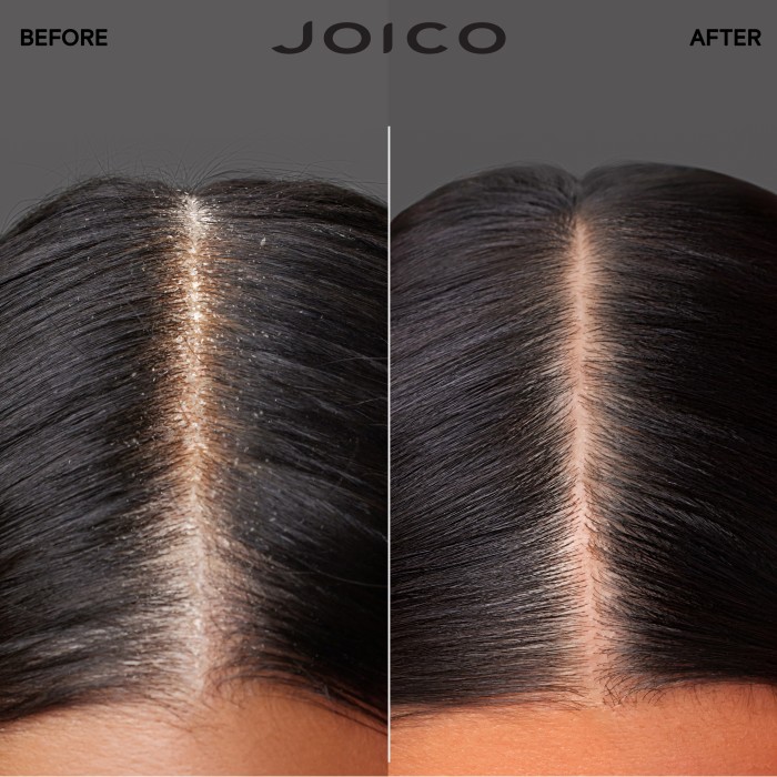 Joico Scalp Vitality Refreshing Shampoo