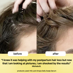 HG Lock Drops Anti-Shedding Scalp & Hair Serum 60ml