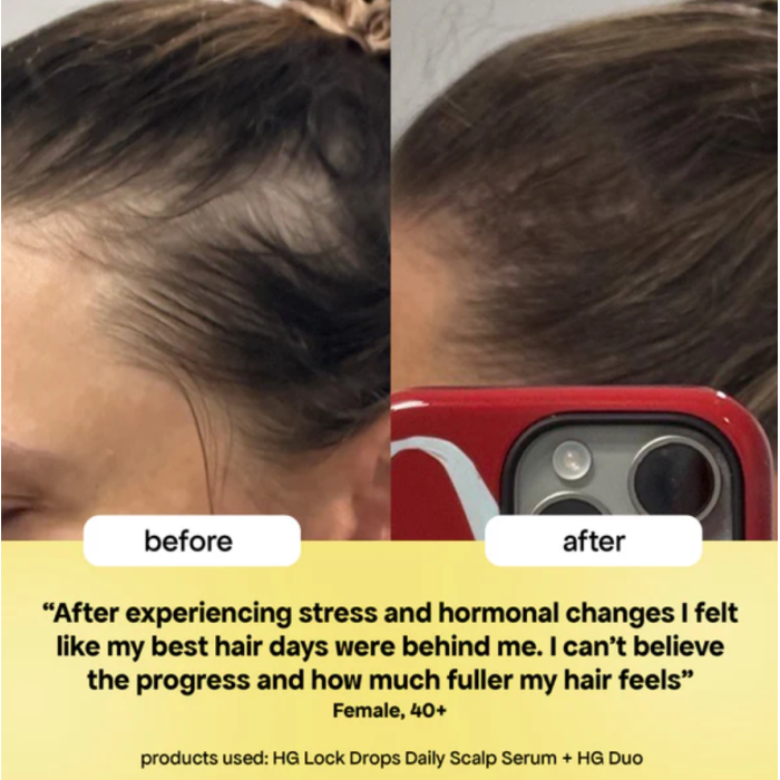 Bondi Boost HG Lock Drops Anti-Shedding Scalp & Hair Serum