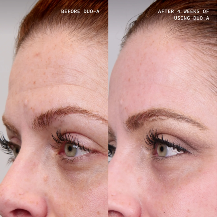 Cosmedix Elite Duo-A 1% Nightly Retinoid Treatment