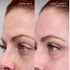 Cosmedix Elite Duo-A 1% Nightly Retinoid Treatment