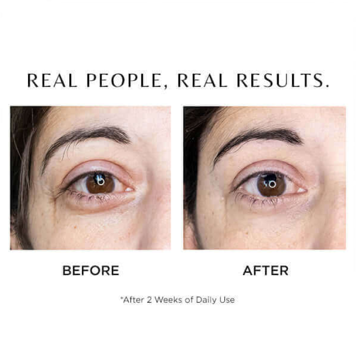 Cosmedix Elite I-Complex Advanced Eye Gel