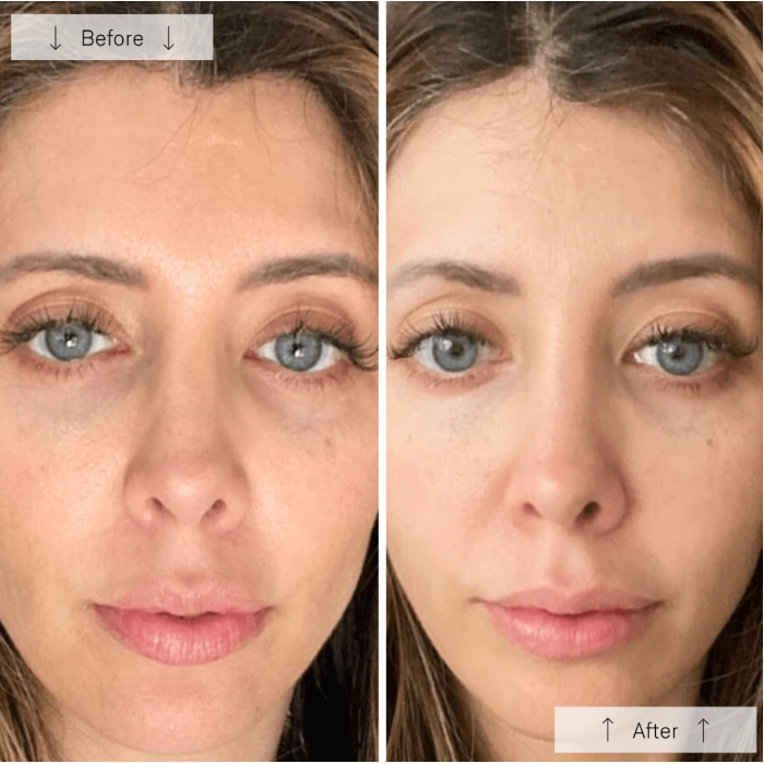 Omnilux Contour Face
