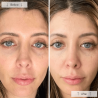 Omnilux Contour Face
