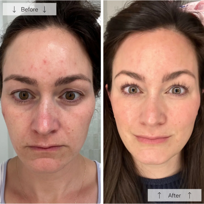 Omnilux Contour Face