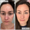 Omnilux Contour Face