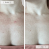 Omnilux Contour Neck & Décolleté