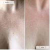 Omnilux Contour Neck & Décolleté