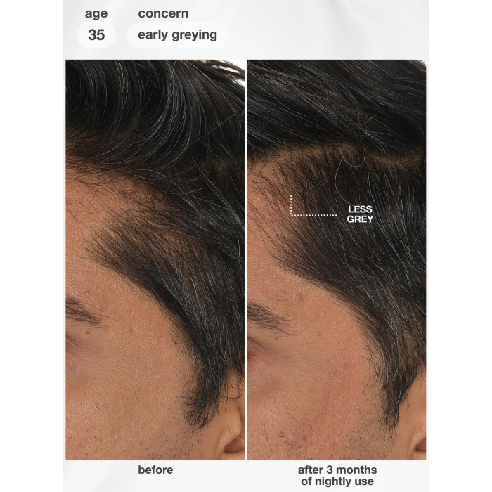 K18 FutureIQ Biomimetic Hair Longevity Serum
