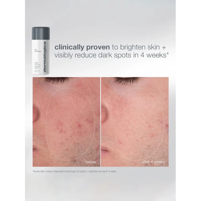 Dermalogica Expert Cleanse + Glow