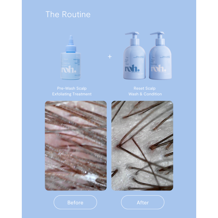 Roh Prewash Scalp Exfoliating Treatment