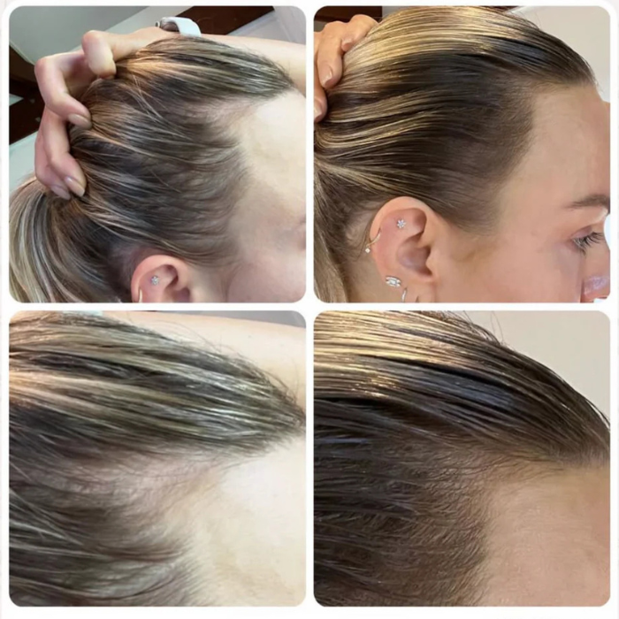 JSHealth Vita-Growth Scalp Serum