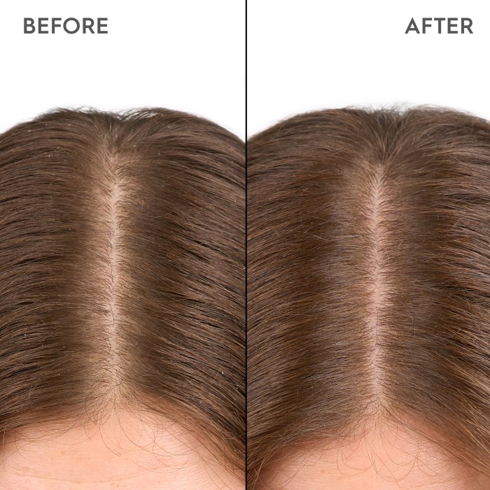 Kerasilk Moisturizing Scalp Drops