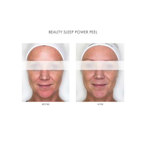 Beauty Sleep Power Peel 50ml