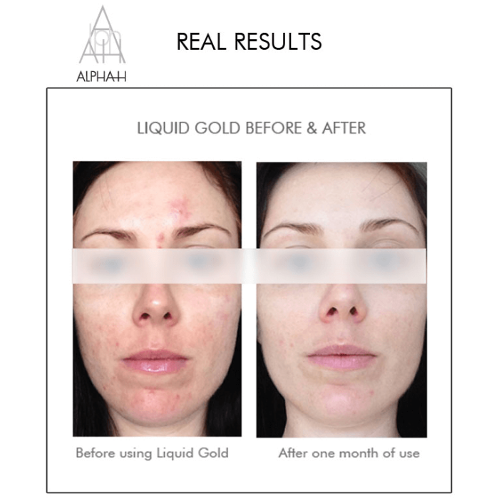 Alpha-H Liquid Gold Alpha-H Liquid Gold