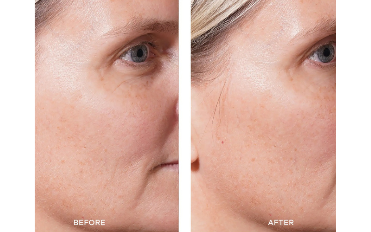 Does Vida Glow Ingestible Collagen Work?