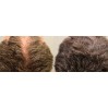 Evolis Professional Reverse 3-Step Hair Restoration System