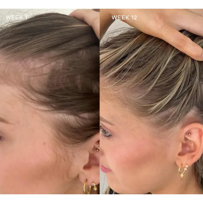 Vida Glow Advanced Repair Hairology 
