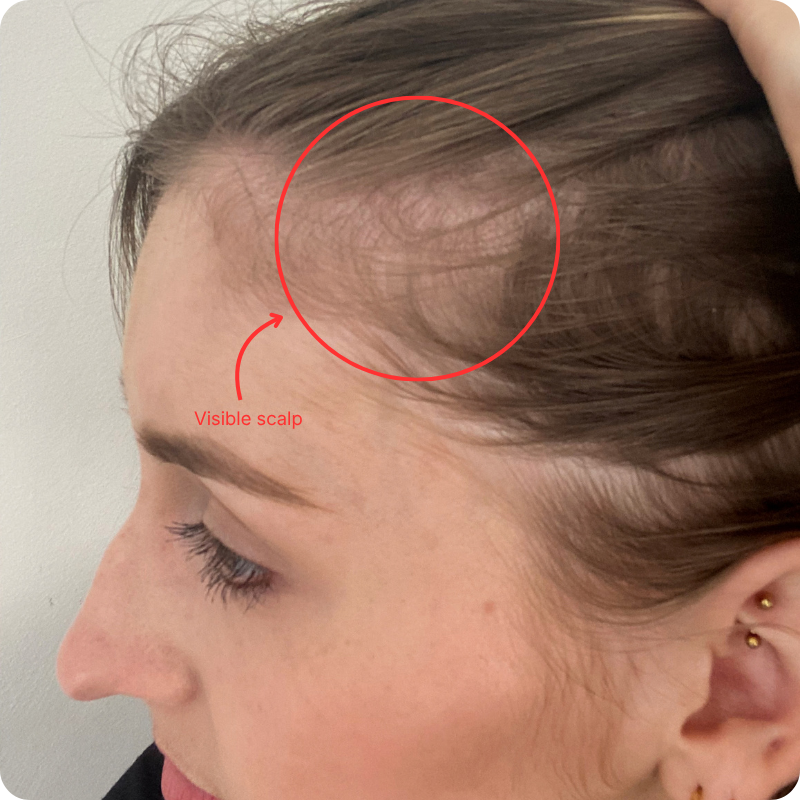 Hair thinning products